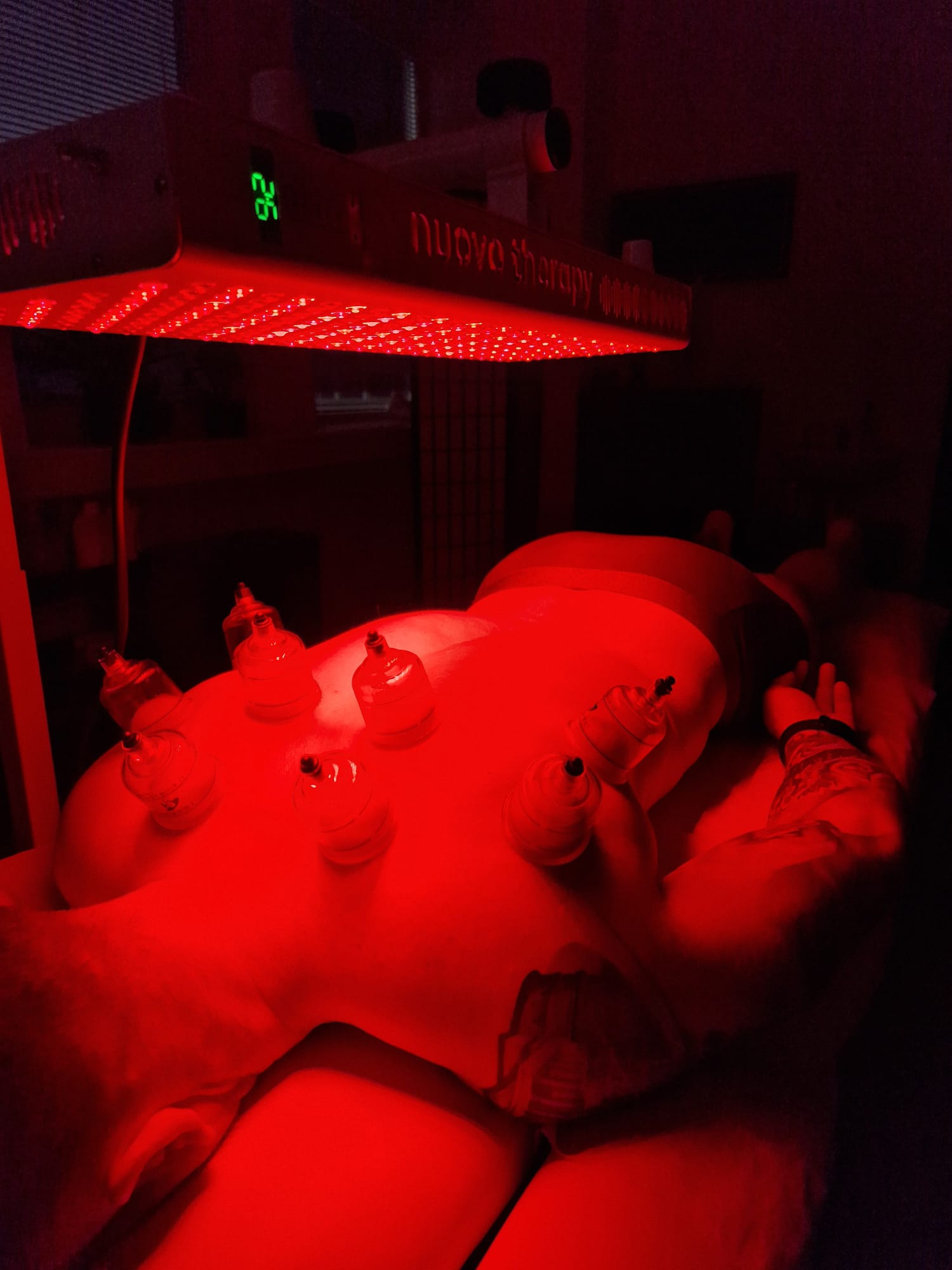 Foto11
